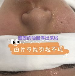 -痘院长·祛痘·皮肤管理