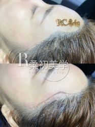 -RC半永久纹眉纹发际线