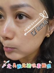 -佳妍惠美科技美肤美体中心
