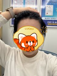 -大麦微针植发全国连锁