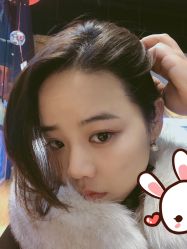 点击看大图 -大麦微针植发丨全国连锁