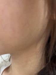 -美瑞莎创美医疗美容