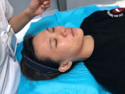 体验后-丽美妍医疗美容·皮秒·立体分层抗衰