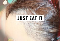 -大麦微针植发全国连锁