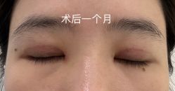 -广州美莱医疗美容医院