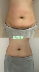 -Lily纤美·科技减脂中心