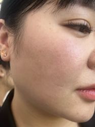 -长沙雅美医疗美容医院