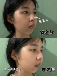 -莆田海峡医疗美容医院
