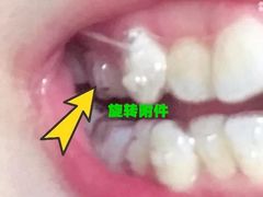 -团圆口腔·种植中心(锦江院区)