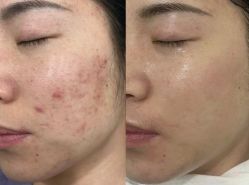-LUNA皮相美·骨相美高级美感