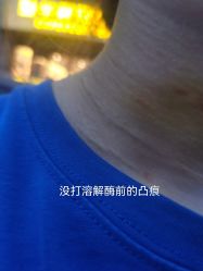 点击看大图 体验后-泉州欧菲医疗美容