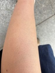 -泉州欧菲医疗美容