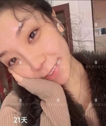 -北京米扬丽格医疗美容·联合丽格鼻整形中心