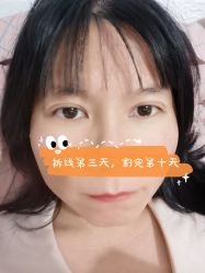 -Yestar宁波艺星整形医院