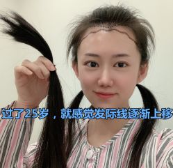 -碧莲盛·不剃发植发