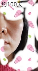 -小忠丽格医美