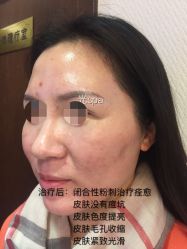 脸部抗衰-光SPA科技美肤