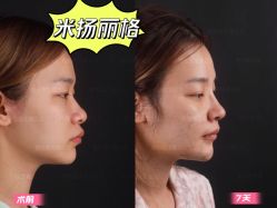 -北京米扬丽格医疗美容·联合丽格鼻整形中心