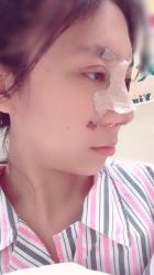 点击看大图 体验后-鑫元辰医疗美容整形