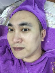 -蕾特恩专业祛痘国际连锁