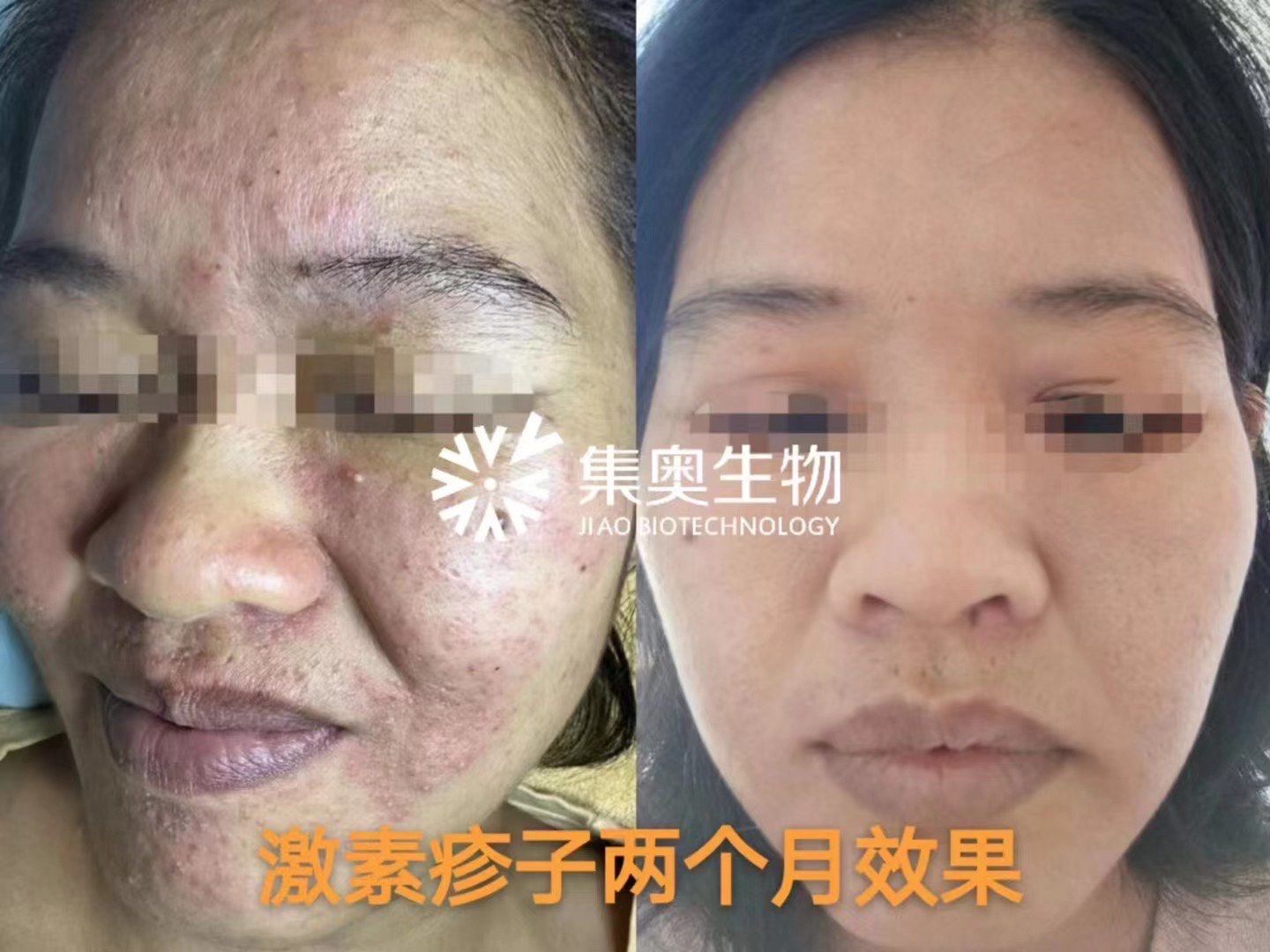 敏兮#肤卉产品技术效果
73 精研问