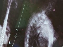 -张钰强中医正骨推拿连锁(华发商都店)