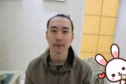 点击看大图 -大麦微针植发丨全国连锁