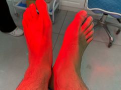 -世龙世家甲沟炎·灰指甲·嵌甲矫正·修脚(武侯区双楠店)