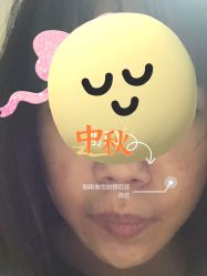 体验后-紫洁俪方（北京）医疗美容