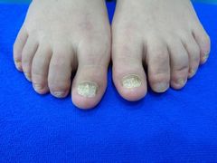 -世龙世家甲沟炎·灰指甲·嵌甲矫正·修脚(武侯区双楠店)