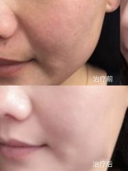 -美莱医学美容医院