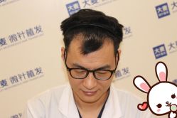 点击看大图 -大麦微针植发丨全国连锁