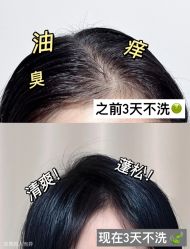 -润复丝·泽发防脱头皮管理