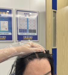 -大麦微针植发全国连锁