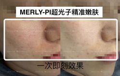 -MLP美丽派·问题肌疗愈中心