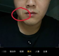 体验后-上海漾颜医疗美容