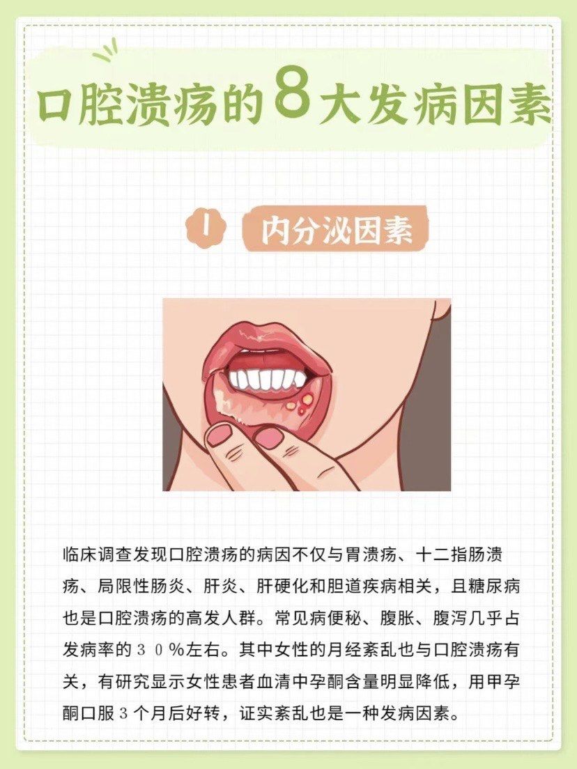 [惊讶]没想到难缠的口腔溃疡,竟是这些原因引起的