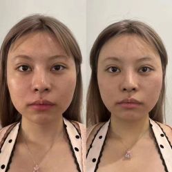 -LUNA皮相美·骨相美高级美感