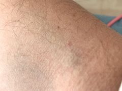 -北京市朝阳区奥运村社区卫生服务中心