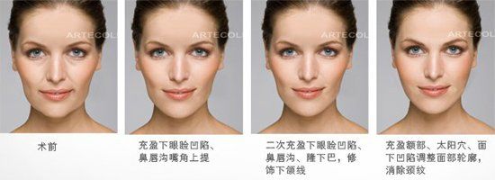 -CMS西美斯·美式医疗美容