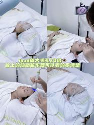 -凡碧诗毛孔清洁收细