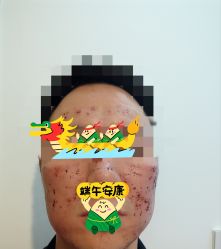 -针美汇欧邦医疗美容