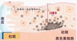 -MLP美丽派·问题肌疗愈中心