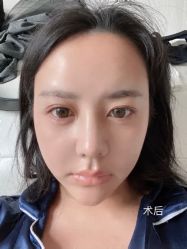 -天津伊美尔医疗整形美容专科医院