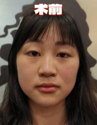 -素美医疗美容·西南眼鼻整形·修复基地