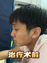 -广州健丽·去眼袋医疗美容机构