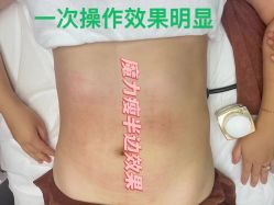 点击看大图 -Lily纤美·科技减脂中心