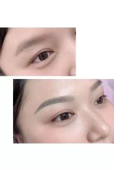 体验前-郡艺医疗美容·微整·眼鼻吸脂