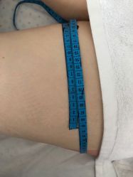 -肥三针腧穴瘦身馆