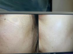 -苑苑vbeauty科技美容SPA
